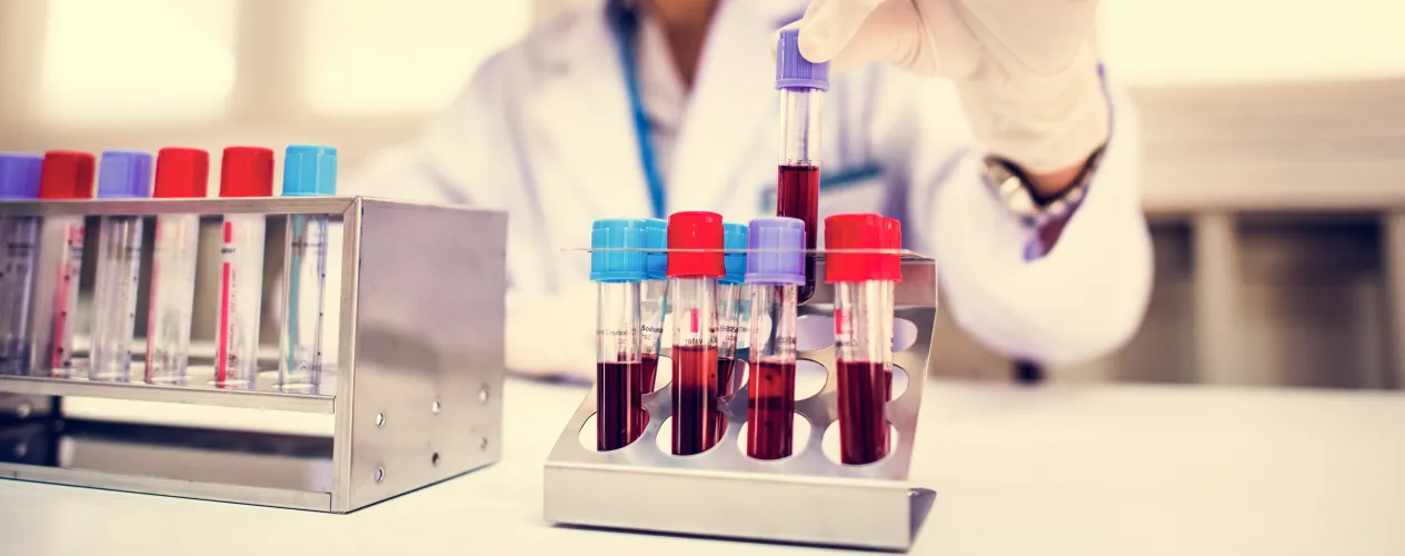 Brewer_Hep A_NPR_All Things Considered_May 7, 2025